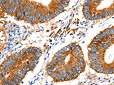 GDF6 Antibody