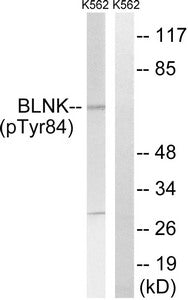 Phospho-BLNK (Tyr84) Antibody