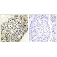 BPIFA4P Antibody