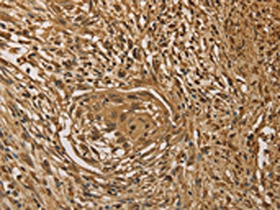 PRDM14 Antibody