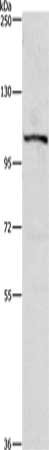 PTK2 Antibody