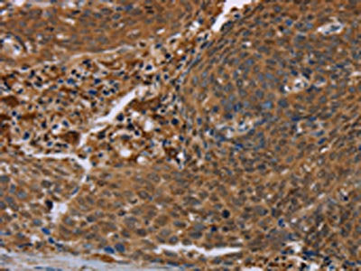 FLG Antibody