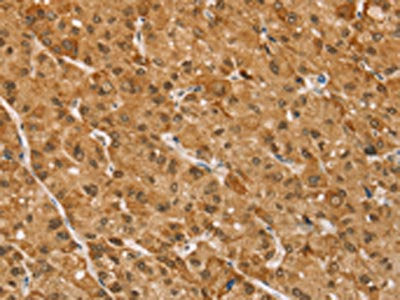 TAF12 Antibody