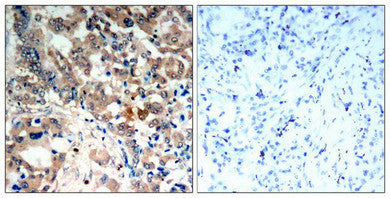 Phospho-PRKAA1/PRKAA2 (Thr183/Thr172) Antibody