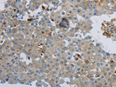 CKMT1A Antibody