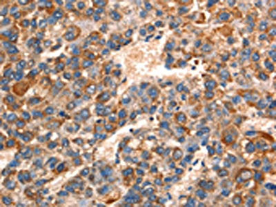 GJA8 Antibody