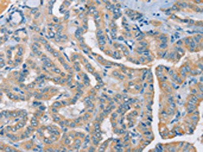 RAD51 Antibody