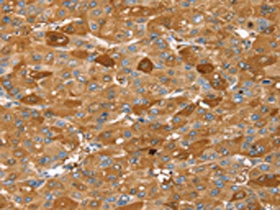 FTH1 Antibody