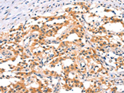 IKBKB Antibody