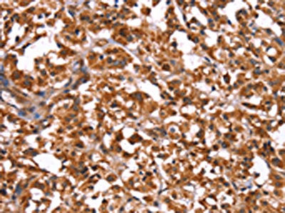GUK1 Antibody
