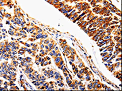 IL1R2 Antibody