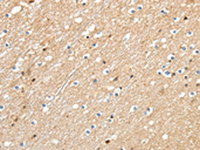 RRAD Antibody