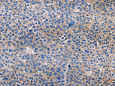 AMACR Antibody