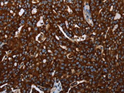 KISS1R Antibody