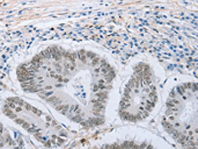 NEUROG2 Antibody