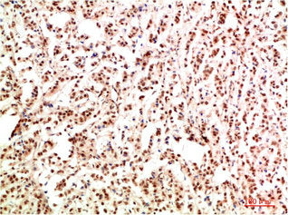 GAB1 Antibody