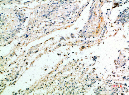 VCAN Antibody