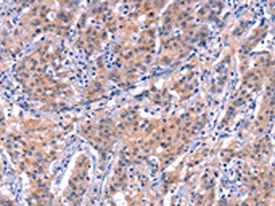 EP300 Antibody