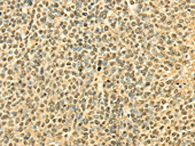 RPA2 Antibody