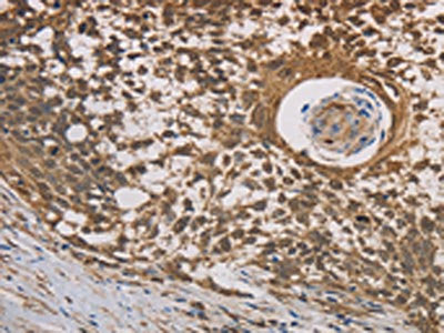 HSF1 Antibody