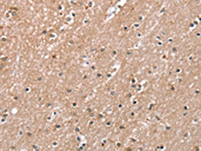 RAB8A Antibody