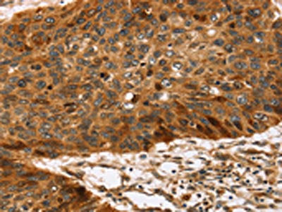 TPST2 Antibody