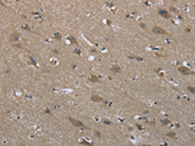 SYT3 Antibody