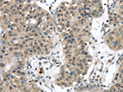 SENP6 Antibody