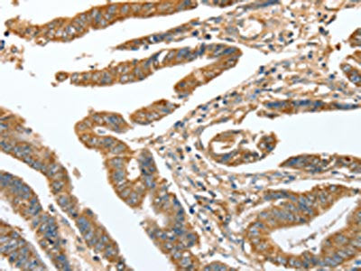 CKAP2 Antibody