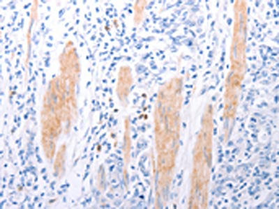 LPAR2 Antibody
