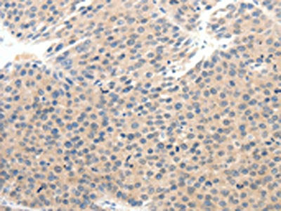 SCN10A Antibody