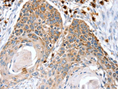 RNF185 Antibody