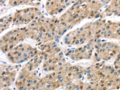 TAB1 Antibody