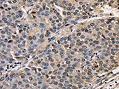 AFP Antibody