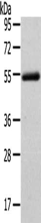 FOXC1 Antibody