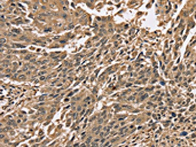 PPP1CC Antibody