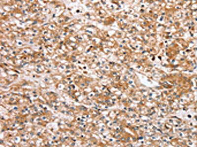 SLC25A20 Antibody