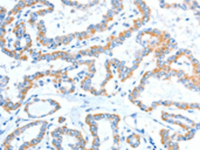 ADAM2 Antibody