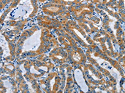 DDAH1 Antibody