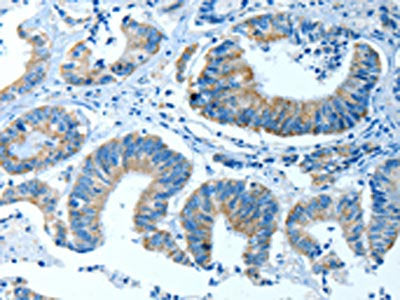 ALDH4A1 Antibody