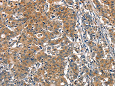 ACPT Antibody