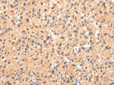 ATP7B Antibody