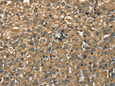 NEMF Antibody