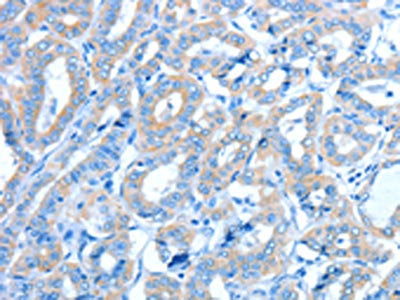 ALDH3B1 Antibody