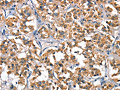 HGF Antibody