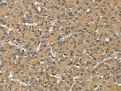 SLC39A3 Antibody
