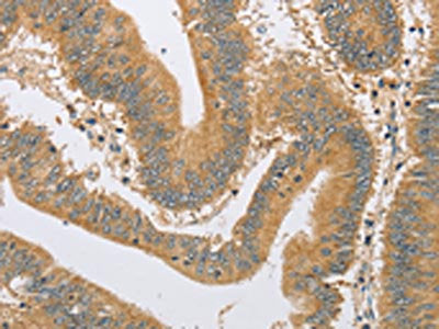 ARHGEF1 Antibody