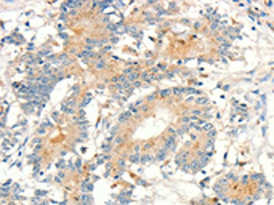 MMP9 Antibody