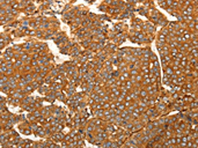 SFRP1 Antibody