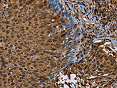 NRP2 Antibody